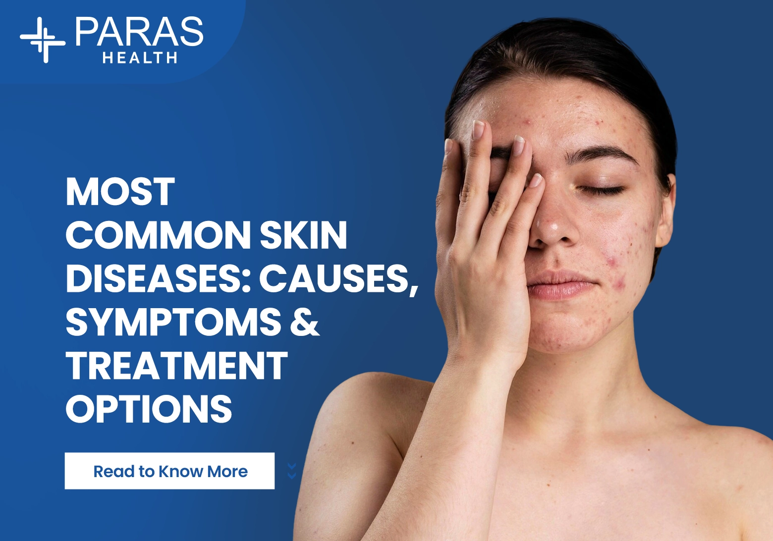 Most Common Skin Diseases: Causes, Symptoms & Treatment Options